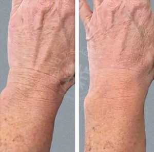 A person with wrinkles on their arms and hands.